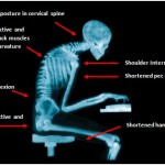 Poor posture: more damaging than you'd think!